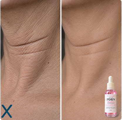 Serum anti Edad